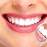 Kullanımı Kolay Di̇ş Kli̇ni̇ği̇ Yazılımı: DentalBulut